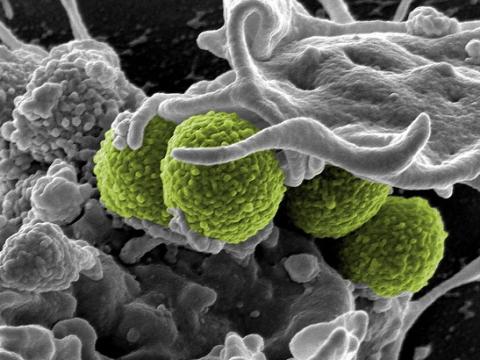 Methicillin-resistant Staphylococcus aureus. Credit: NIAID