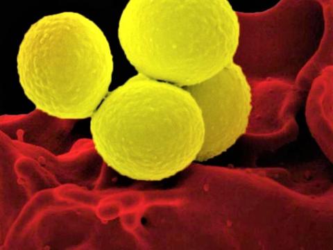 MRSA in blood
