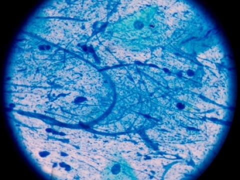 Mycobacterium tuberculosis