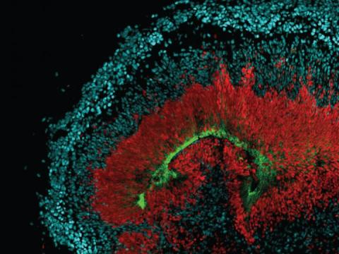 Neural stem cell
