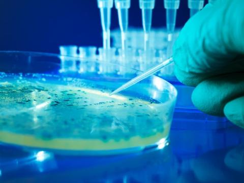 Salmonella colonies in petrie dish