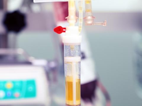 Plasma transfusion