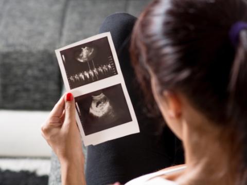 Pregnant woman with ultrasound