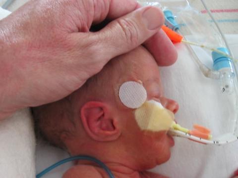 Premature baby