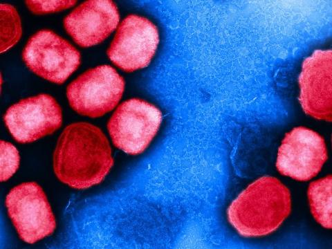 Monkeypox viruses as seen through a microscope