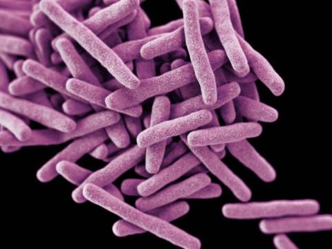 Drug-resistant Mycobacterium tuberculosis