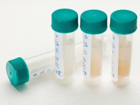 Saliva samples