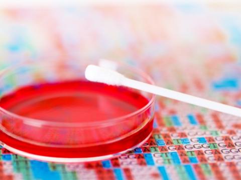 Sample of DNA
