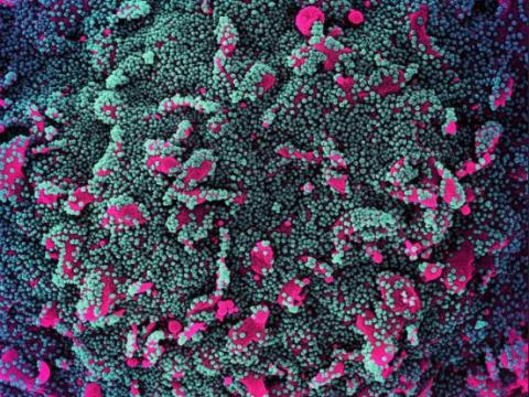 SARS-CoV-2 viruses magnified
