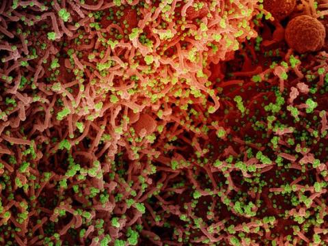 SARS-CoV-2 highly magnified