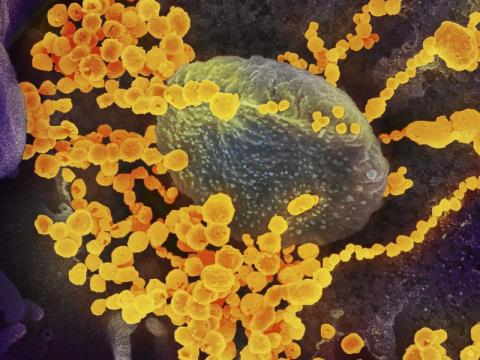 SARS-CoV-2 under microscope