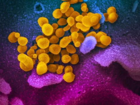 COVID-19 virus highly magnified