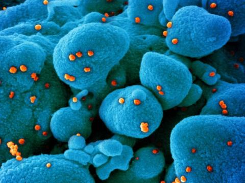 SARS-CoV-2 viruses magnified