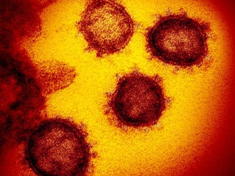 SARS-CoV-2 viruses highly magnified