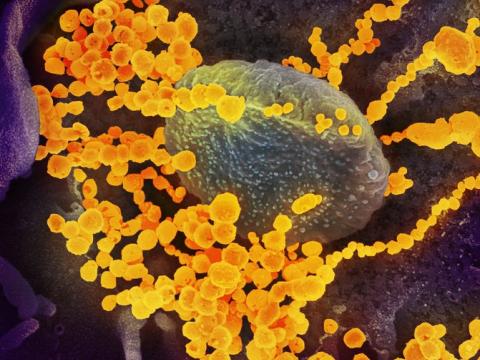 SARS-CoV-2 virus, highly magnified