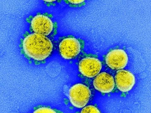 SARS-CoV-2 viruses highly magnified