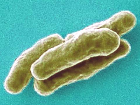 Mycobacterium tuberculosis highly magnified
