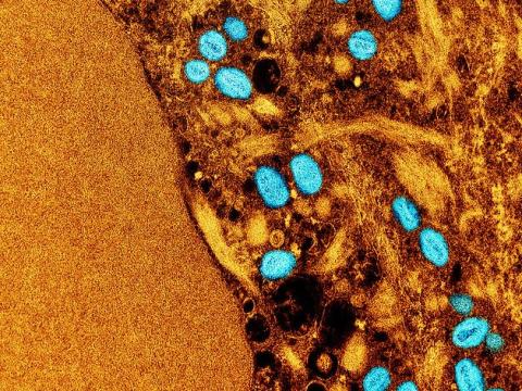 Monkeypox viruses highly magnified