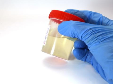 Urinalysis container