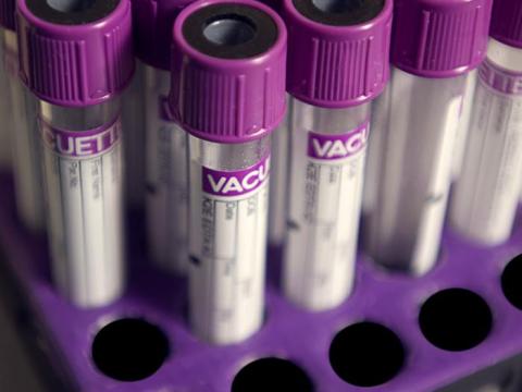 Vacutainer blood testing tubes
