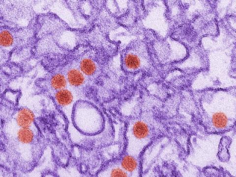 Zika virus