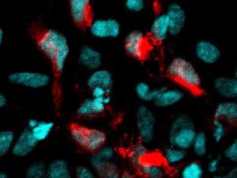 Zika-infected neural cells