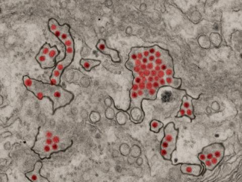 Zika virus