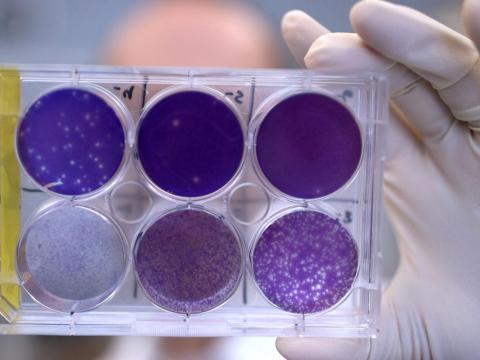 Zika antibodies