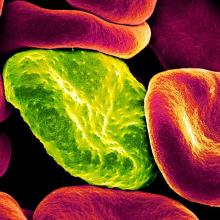 Bacterium in red blood cells