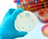 Antimicrobial susceptibility test petri dish