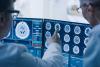 Doctors assessing brain scans