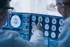 Doctors assessing brain scans