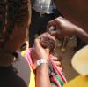 Baby receiving oral polio vaccine