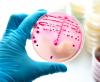 Bacterial culture in petri dish