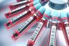 Blood centrifuge