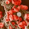 Platelets forming a blood clot