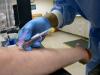 Blood draw