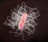 C difficile