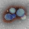 MERS-CoV as revealed by an electron microscope