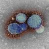 Electron micrograph of MERS-CoV