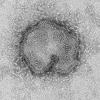 h7n9 electron microscope image