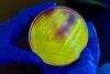 Clostridium difficile on agar plate