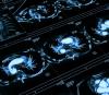 Chest CT scan