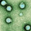 Chikungunya virus micrograph