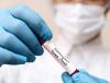 Specimen tube for monkeypox test