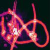 Ebola virus