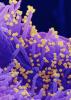 SARS-CoV-2 viruses highly magnified