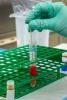 COVID-19 lab testing