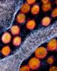 COVID-19 coronaviruses