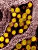 COVID-19 viruses